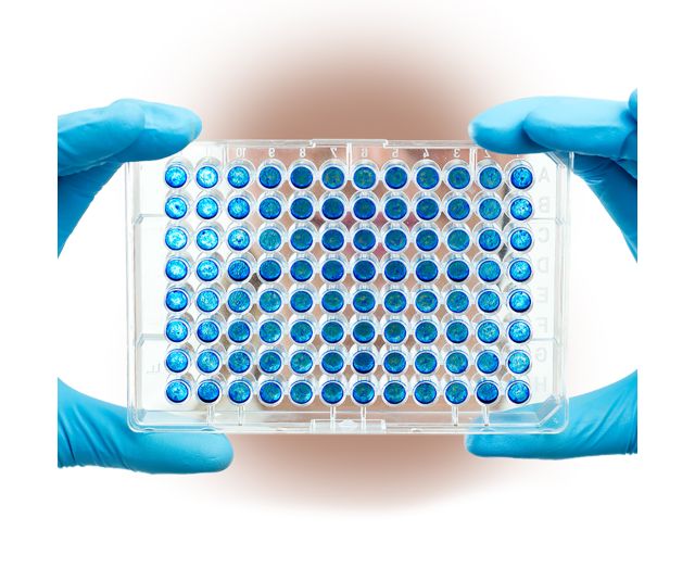 酶聯免疫吸附實驗